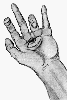 Hand 1